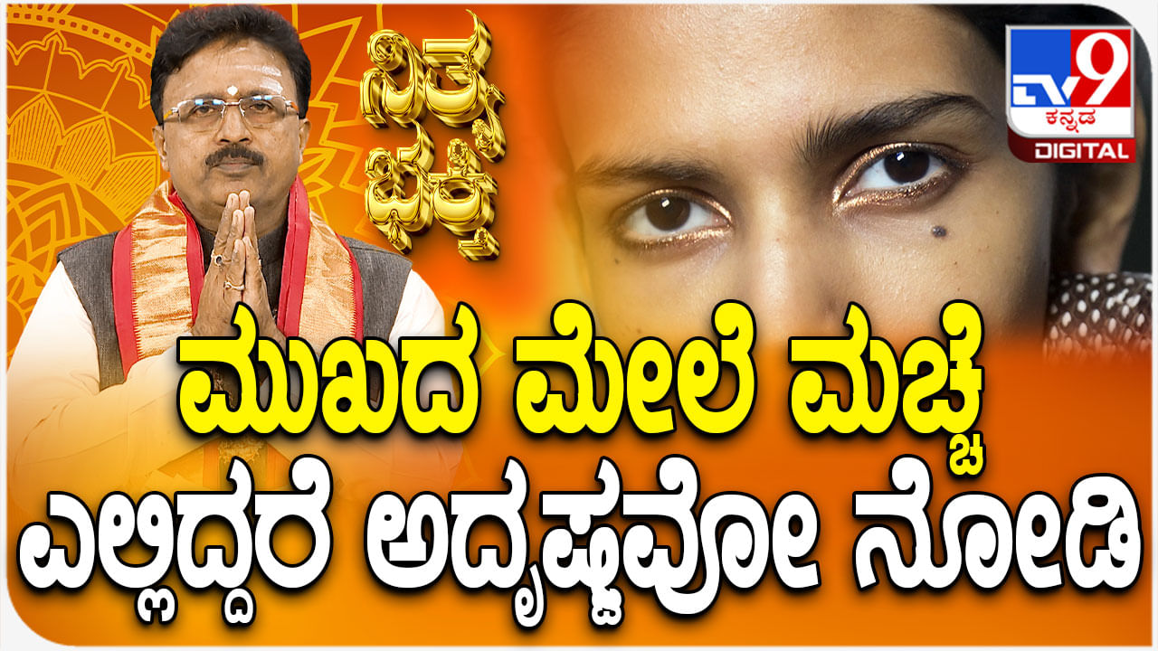 Daily Devotional: ಮುಖದ ಮೇಲೆ ಮಚ್ಚೆ ಎಲ್ಲಿದ್ದರೆ ಅದೃಷ್ಟ ತಿಳಿಯಿರಿ