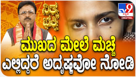 Daily Devotional: ಮುಖದ ಮೇಲೆ ಮಚ್ಚೆ ಎಲ್ಲಿದ್ದರೆ ಅದೃಷ್ಟ ತಿಳಿಯಿರಿ Daily Devotional: ಮುಖದ ಮೇಲೆ ಮಚ್ಚೆ ಎಲ್ಲಿದ್ದರೆ ಅದೃಷ್ಟ ತಿಳಿಯಿರಿ