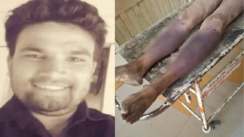ಇಂದೋರ್: ಕಳ್ಳತನ ಆರೋಪ, ಗುಂಪಿನಿಂದ ಹಲ್ಲೆ, 40 ಮೂಳೆಗಳು ಮುರಿತ, ವ್ಯಕ್ತಿ ಸಾವು