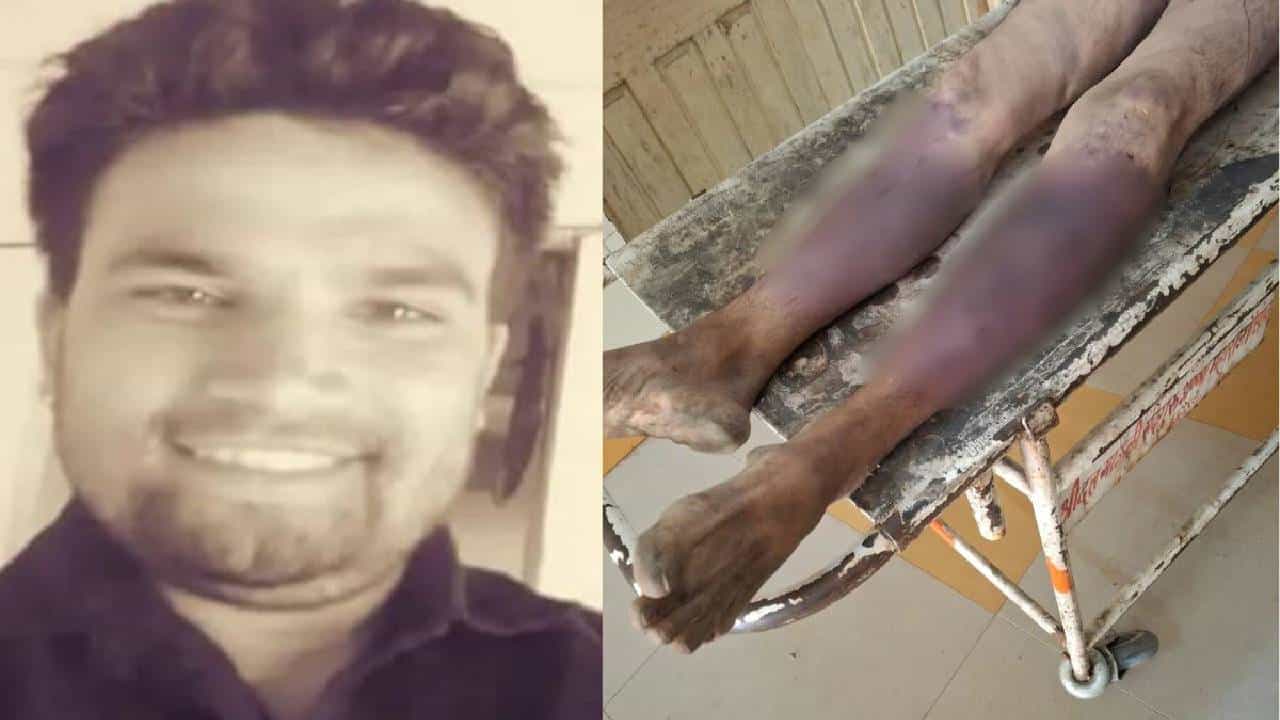 ಇಂದೋರ್: ಕಳ್ಳತನ ಆರೋಪ, ಗುಂಪಿನಿಂದ ಹಲ್ಲೆ, 40 ಮೂಳೆಗಳು ಮುರಿತ, ವ್ಯಕ್ತಿ ಸಾವು