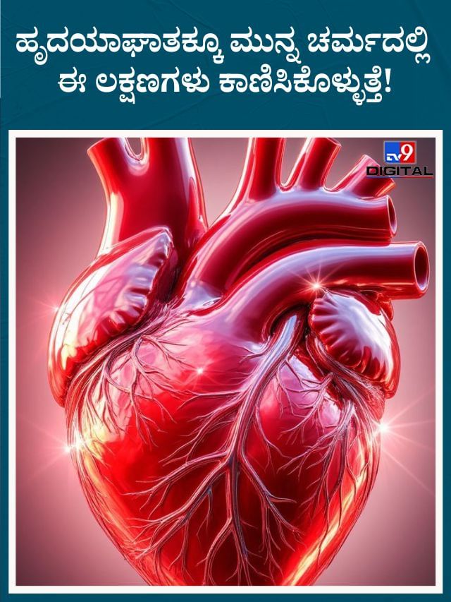 ಚರ್ಮದ ಮೇಲೆ ಈ ಸಮಸ್ಯೆಗಳು ಕಾಣಿಸಿಕೊಂಡರೆ ಅದು ಹೃದಯಾಘಾತದ ಲಕ್ಷಣವಾಗಿರಬಹುದು