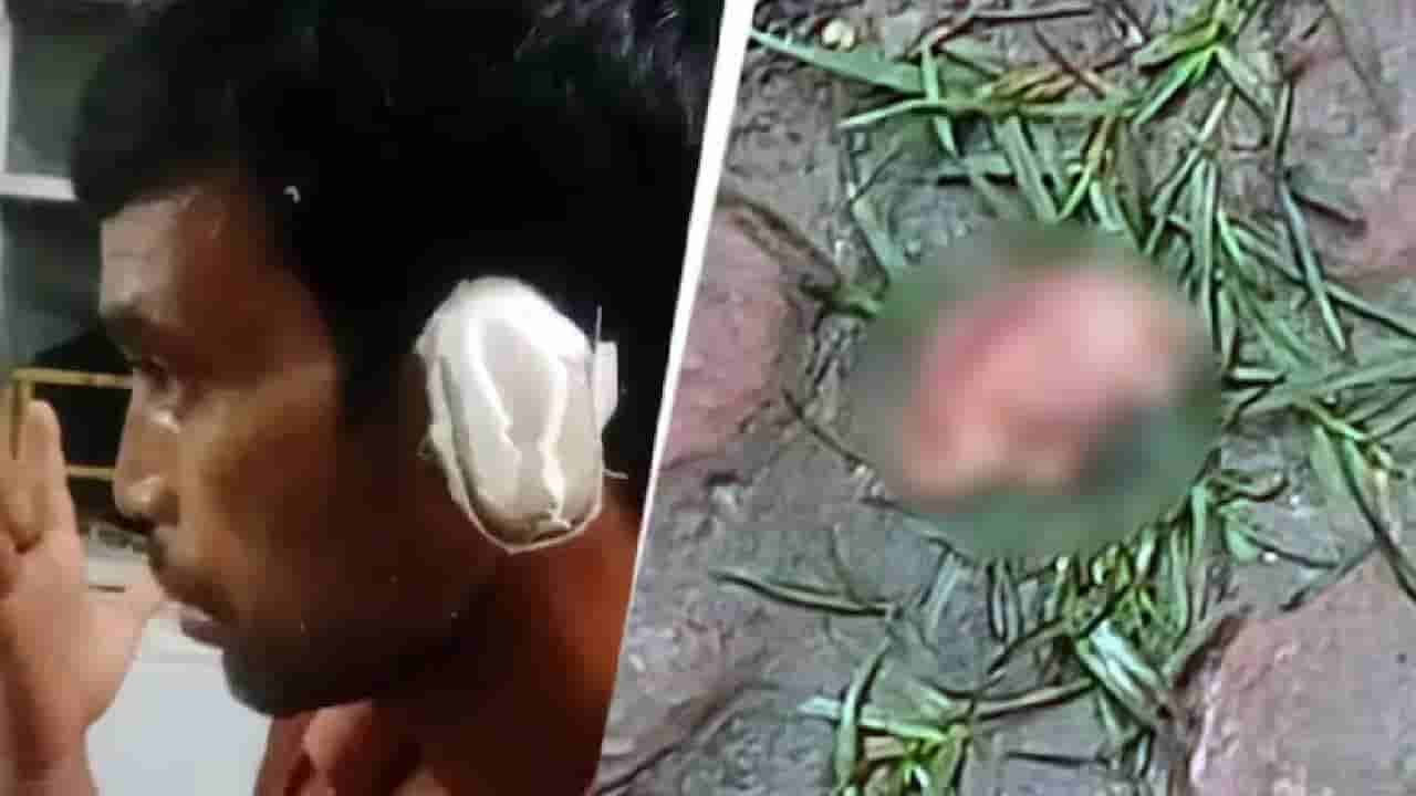 ಹಣದ ವಿಚಾರದಲ್ಲಿ ಜಗಳ, ಸಾಲ ಪಡೆದವನ ಕಿವಿ ಕಚ್ಚಿ ಕತ್ತರಿಸಿದ ವ್ಯಕ್ತಿ