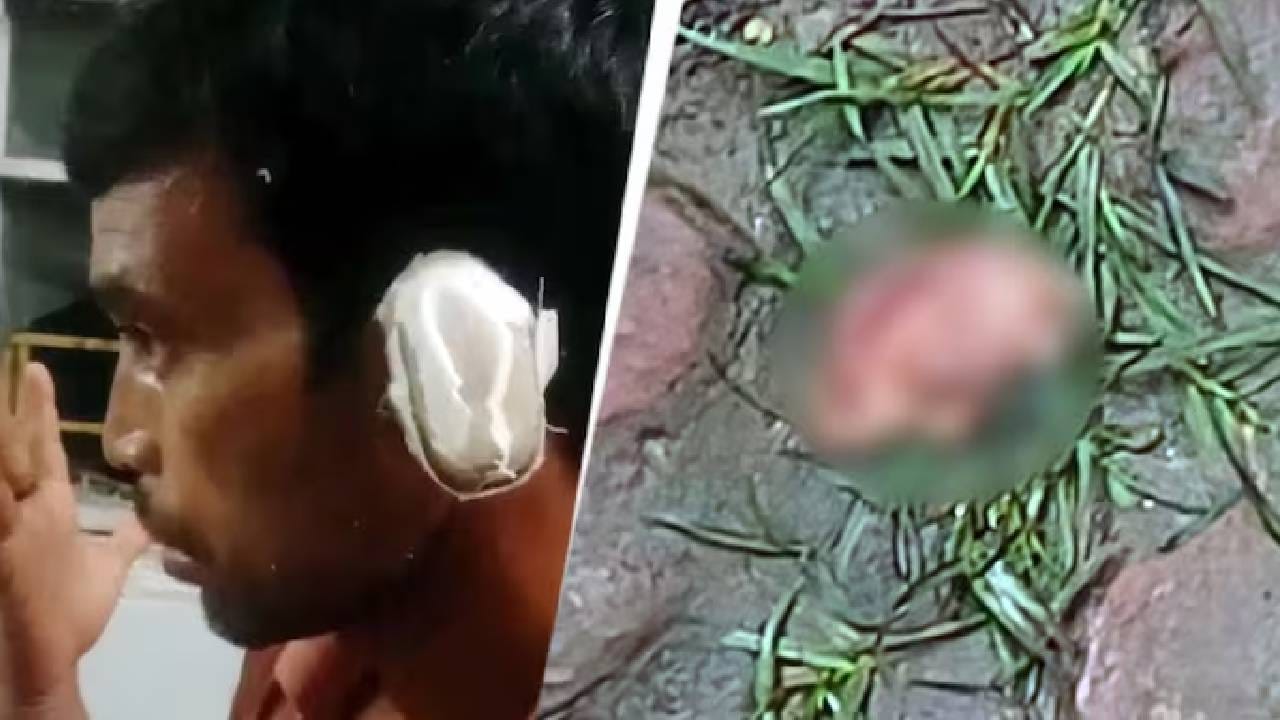 ಹಣದ ವಿಚಾರದಲ್ಲಿ ಜಗಳ, ಸಾಲ ಪಡೆದವನ ಕಿವಿ ಕಚ್ಚಿ ಕತ್ತರಿಸಿದ ವ್ಯಕ್ತಿ ಹಣದ ವಿಚಾರದಲ್ಲಿ ಜಗಳ, ಸಾಲ ಪಡೆದವನ ಕಿವಿ ಕಚ್ಚಿ ಕತ್ತರಿಸಿದ ವ್ಯಕ್ತಿ