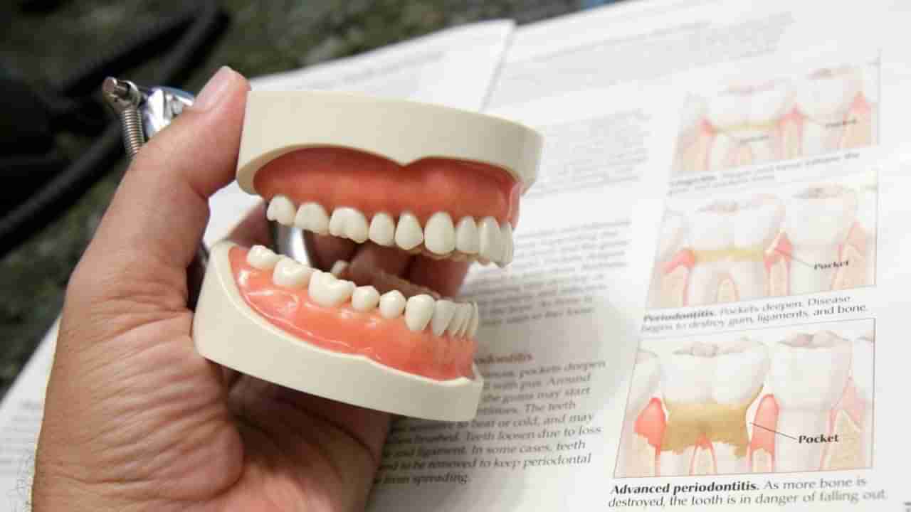 ಒಸಡುಗಳಿಂದ ರಕ್ತಸ್ರಾವವಾಗುವುದಕ್ಕೂ ಹೃದಯ ಸಂಬಂಧಿ ಕಾಯಿಲೆ ಬರುವುದಕ್ಕೂ ಸಂಬಂಧವಿದೆಯೇ?