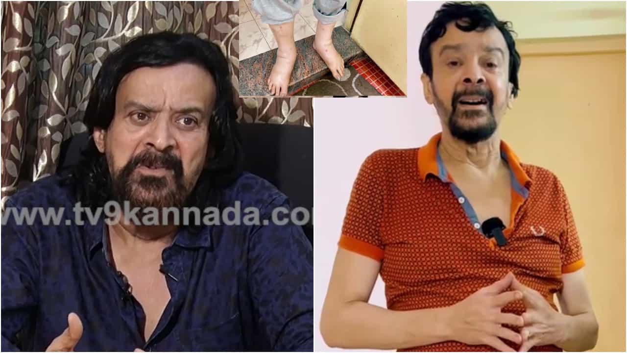 ಹರೀಶ್ ರಾಯ್ ಪರಿಸ್ಥಿತಿ ನೋಡಿದ್ರೆ ಕಣ್ಣೀರು ಬರುತ್ತೆ; ಸಹಾಯಕ್ಕಾಗಿ ಅಂಗಲಾಚಿದ ‘ಕೆಜಿಎಫ್’ ಚಾಚಾ