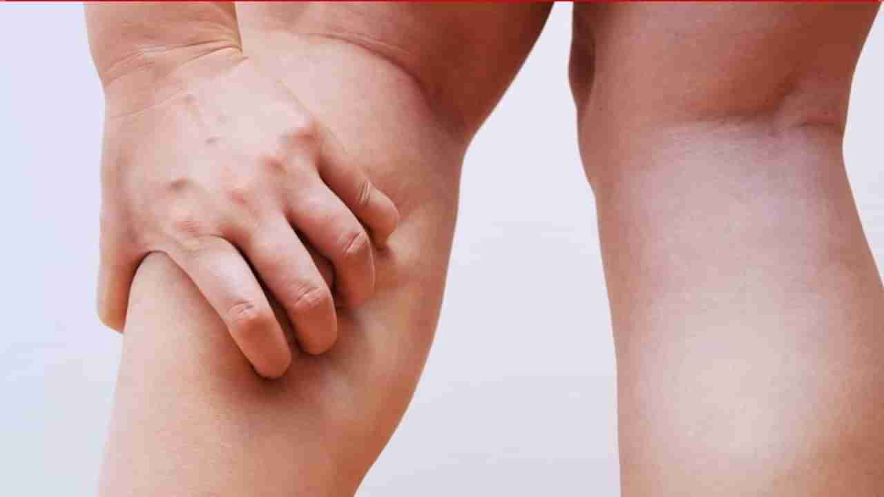 ರಾತ್ರಿ ಕಾಲು ಊದಿಕೊಳ್ಳುತ್ತದೆಯೇ? ಈ ಸಮಸ್ಯೆಗಳಿಗೆ ಇಲ್ಲಿದೆ ನೋಡಿ ಪರಿಹಾರ