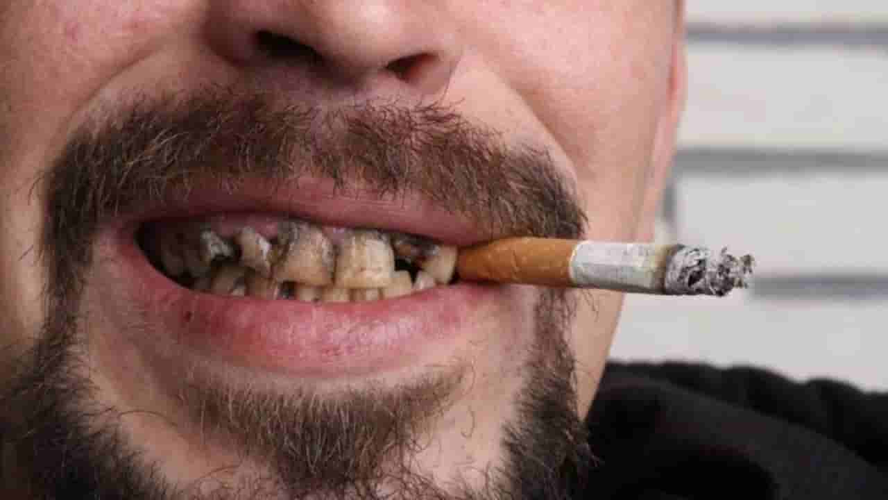 ಸಿಗರೇಟ್ ಜತೆಗೆ ಕಾಫಿ ಕುಡಿಯುವವರ ಹಲ್ಲುಗಳು ಹಳದಿ ಇರುತ್ತದೆ ಯಾಕೆ? ಬಿಳಿಯಾಗಿಸಲು ಈ ಮೂರು ಸಲಹೆ ಅನುಸರಿಸಿ