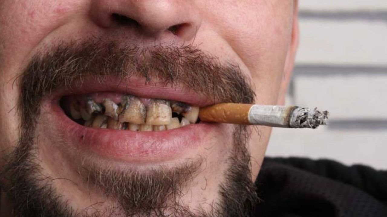 ಸಿಗರೇಟ್ ಜತೆಗೆ ಕಾಫಿ ಕುಡಿಯುವವರ ಹಲ್ಲುಗಳು ಹಳದಿ ಇರುತ್ತದೆ ಯಾಕೆ? ಬಿಳಿಯಾಗಿಸಲು ಈ ಮೂರು ಸಲಹೆ ಅನುಸರಿಸಿ ಸಿಗರೇಟ್ ಜತೆಗೆ ಕಾಫಿ ಕುಡಿಯುವವರ ಹಲ್ಲುಗಳು ಹಳದಿ ಇರುತ್ತದೆ ಯಾಕೆ? ಬಿಳಿಯಾಗಿಸಲು ಈ ಮೂರು ಸಲಹೆ ಅನುಸರಿಸಿ
