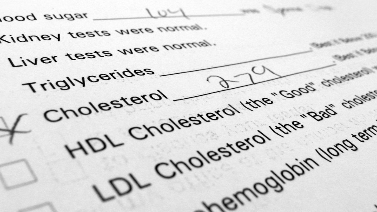 ದೇಹದಲ್ಲಿ ಕೊಲೆಸ್ಟ್ರಾಲ್ ಹೆಚ್ಚಾಗಿದೆಯೋ, ಇಲ್ಲವೋ ಎಂಬುದನ್ನು ಹೇಗೆ ತಿಳಿಯಬಹುದು? ದೇಹದಲ್ಲಿ ಕೊಲೆಸ್ಟ್ರಾಲ್ ಹೆಚ್ಚಾಗಿದೆಯೋ, ಇಲ್ಲವೋ ಎಂಬುದನ್ನು ಹೇಗೆ ತಿಳಿಯಬಹುದು?