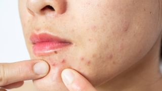 ಚಹಾ ಮಾಡುವಾಗ ಎಂದಿಗೂ ಈ ತಪ್ಪುಗಳನ್ನು ಮಾಡಲೇಬೇಡಿ; ಯಾಕೆ ಗೊತ್ತಾ?