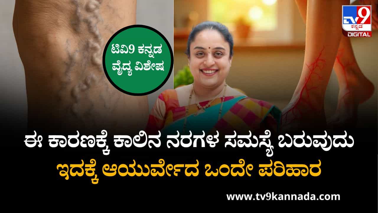 ಕಾಲಿನಲ್ಲಿ ಉಂಟಾಗುವ ನರಗಳ ಸಮಸ್ಯೆಗೆ ಪರಿಹಾರ ಕಂಡುಕೊಳ್ಳಬೇಕಾ? ಡಾ ಪ್ರತಿಭಾ ಜಿ ಭಟ್ ಅವರು ನೀಡಿರುವ ಸಲಹೆ ಇಲ್ಲಿದೆ