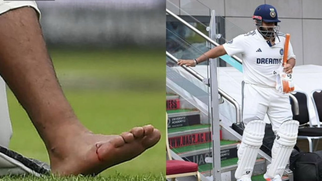 ವಾಸ್ತವವಾಗಿ ಉಭಯ ತಂಡಗಳ ನಡುವೆ ನಡೆದ ನಾಲ್ಕನೇ ಟೆಸ್ಟ್ ಪಂದ್ಯದ ವೇಳೆ ಟೀಂ ಇಂಡಿಯಾದ ವಿಕೆಟ್‌ಕೀಪರ್ ಬ್ಯಾಟ್ಸ್‌ಮನ್ ರಿಷಭ್ ಪಂತ್ ಬ್ಯಾಟಿಂಗ್ ಮಾಡುವ ವೇಳೆ, ಇಂಗ್ಲೆಂಡ್‌ ವೇಗಿ ಕ್ರಿಸ್ ವೋಕ್ಸ್ ಎಸೆದ ಬೆಂಕಿ ಎಸೆತ ಪಂತ್ ಅವರ ಕಾಲಿಗೆ ಬಡಿಯಿತು. ಇದರಿಂದಾಗಿ ಅರ್ಧದಲ್ಲೇ ಮೈದಾನ ತೊರೆದಿದ್ದ ಪಂತ್ ಅವರ ಕಾಲ್ಬೆರಳಿನಲ್ಲಿ ಮೂಳೆ ಮುರಿತ ಉಂಟಾಗಿದೆ ಎಂದು ವರದಿಯಾಗಿತ್ತು. ಹೀಗಾಗಿ ಸರಣಿಯ ಕೊನೆಯ ಪಂದ್ಯದಿಂದ ಪಂತ್ ಹೊರಗುಳಿದಿದ್ದರು.
