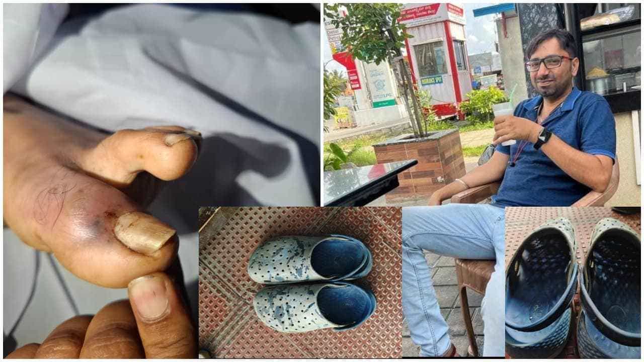 ಕ್ರಾಕ್ಸ್ ಚಪ್ಪಲಿಯಲ್ಲಿ ಅಡಗಿದ್ದ ಹಾವು ಕಚ್ಚಿ ವ್ಯಕ್ತಿ ದುರಂತ ಸಾವು