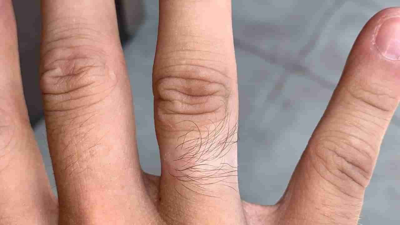 Samudrik Shastra: ಬೆರಳುಗಳ ಮೇಲೆ ತುಂಬಾ ಕೂದಲು ಇರೋದು ಅದೃಷ್ಟನಾ? ಸಾಮುದ್ರಿಕ ಶಾಸ್ತ್ರ ಹೇಳುವುದೇನು?