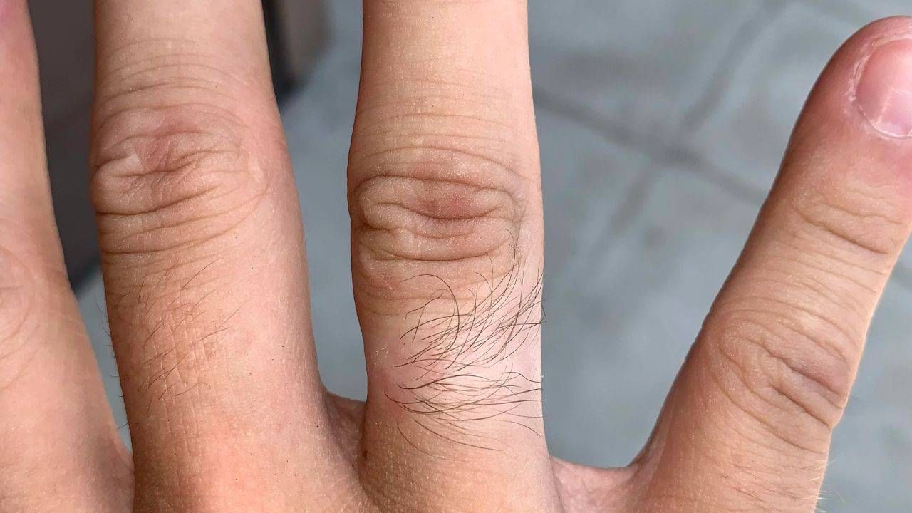 Samudrik Shastra: ಬೆರಳುಗಳ ಮೇಲೆ ತುಂಬಾ ಕೂದಲು ಇರೋದು ಅದೃಷ್ಟನಾ? ಸಾಮುದ್ರಿಕ ಶಾಸ್ತ್ರ ಹೇಳುವುದೇನು? Samudrik Shastra: ಬೆರಳುಗಳ ಮೇಲೆ ತುಂಬಾ ಕೂದಲು ಇರೋದು ಅದೃಷ್ಟನಾ? ಸಾಮುದ್ರಿಕ ಶಾಸ್ತ್ರ ಹೇಳುವುದೇನು?