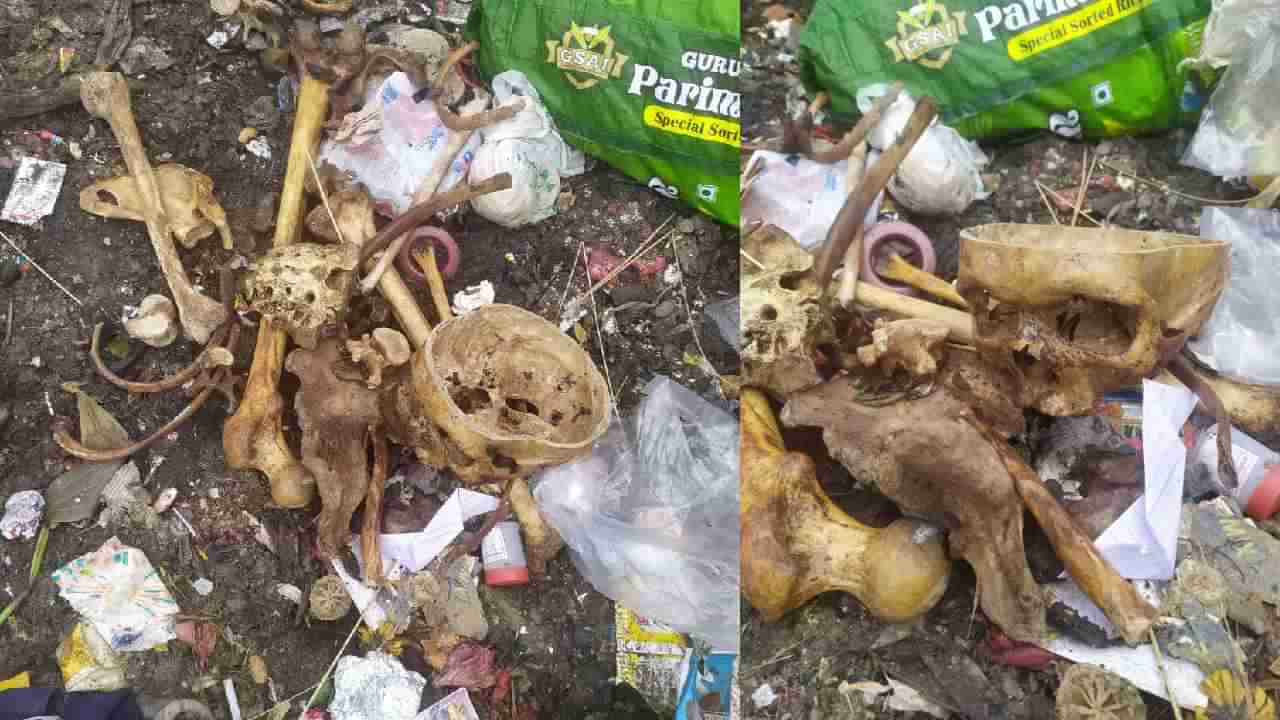 ಬೆಂಗಳೂರು: ಕಸದಲ್ಲಿ ಮನುಷ್ಯನ ತಲೆಬುರುಡೆ, ಮೂಳೆಗಳು ಪತ್ತೆ, ಬೆಚ್ಚಿಬಿದ್ದ ಎಲೆಕ್ಟ್ರಾನಿಕ್ ಸಿಟಿ ಜನ