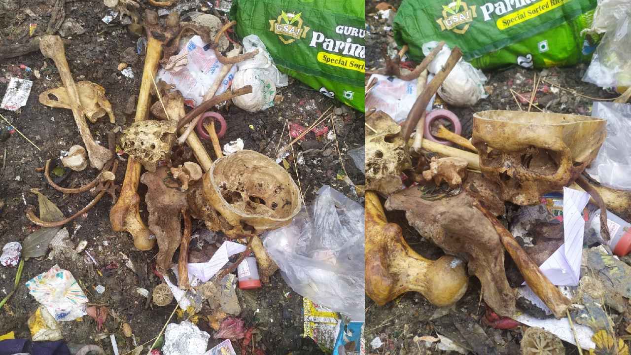 ಬೆಂಗಳೂರು: ಕಸದಲ್ಲಿ ಮನುಷ್ಯನ ತಲೆಬುರುಡೆ, ಮೂಳೆಗಳು ಪತ್ತೆ, ಬೆಚ್ಚಿಬಿದ್ದ ಎಲೆಕ್ಟ್ರಾನಿಕ್ ಸಿಟಿ ಜನ