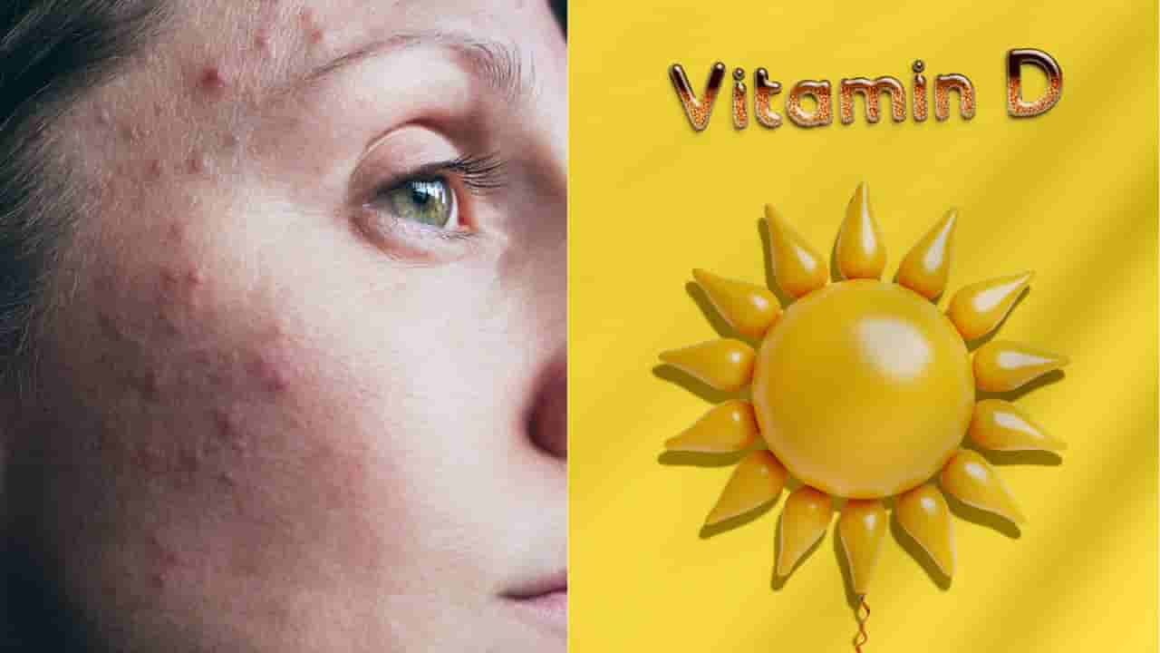 ಮುಖದಲ್ಲಿ ಕಂಡು ಬರುವ ಲಕ್ಷಣಗಳಿಂದಲೇ ವಿಟಮಿನ್ ಡಿ ಕೊರತೆಯನ್ನು ಕಂಡು ಹಿಡಿಯಬಹುದು! ಹೇಗೆ ಗೊತ್ತಾ?