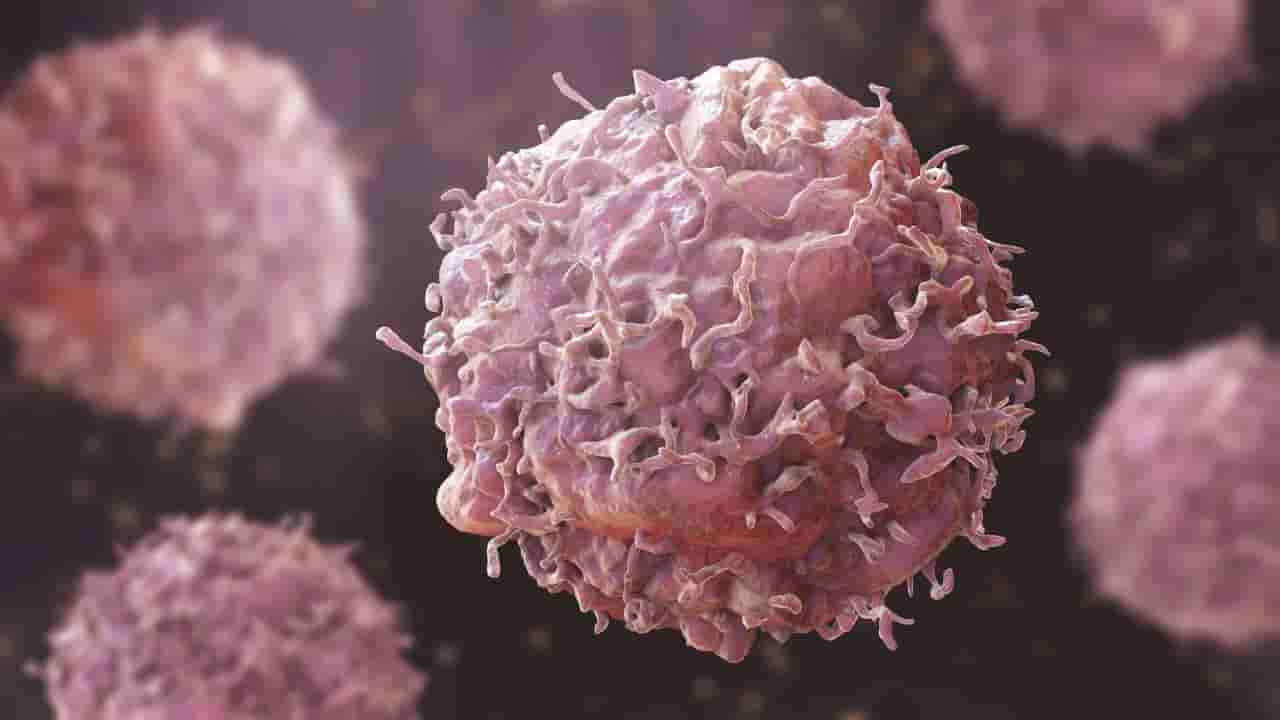 ಕರುಳಿನ ಕ್ಯಾನ್ಸರ್: ರಷ್ಯಾದಿಂದ ಲಸಿಕೆ ಸಿದ್ಧ; ನಿರುಪದ್ರವಿ ವೈರಸ್ ಬಳಸಿ ಕ್ಯಾನ್ಸರ್ ಕೋಶಗಳ ನಾಶ ಮಾಡಬಲ್ಲ ಪ್ರಬಲ ವ್ಯಾಕ್ಸಿನ್