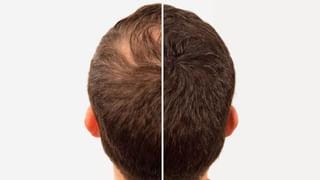 ರಾತ್ರಿ ಏಳು ಗಂಟೆಯ ನಂತರ ನೀವು ಕೂಡ ಈ ಆಹಾರಗಳ ಸೇವನೆ ಮಾಡುತ್ತಿದ್ದರೆ ಈ ಸ್ಟೋರಿ ಮಿಸ್ ಮಾಡ್ದೆ ಓದಿ