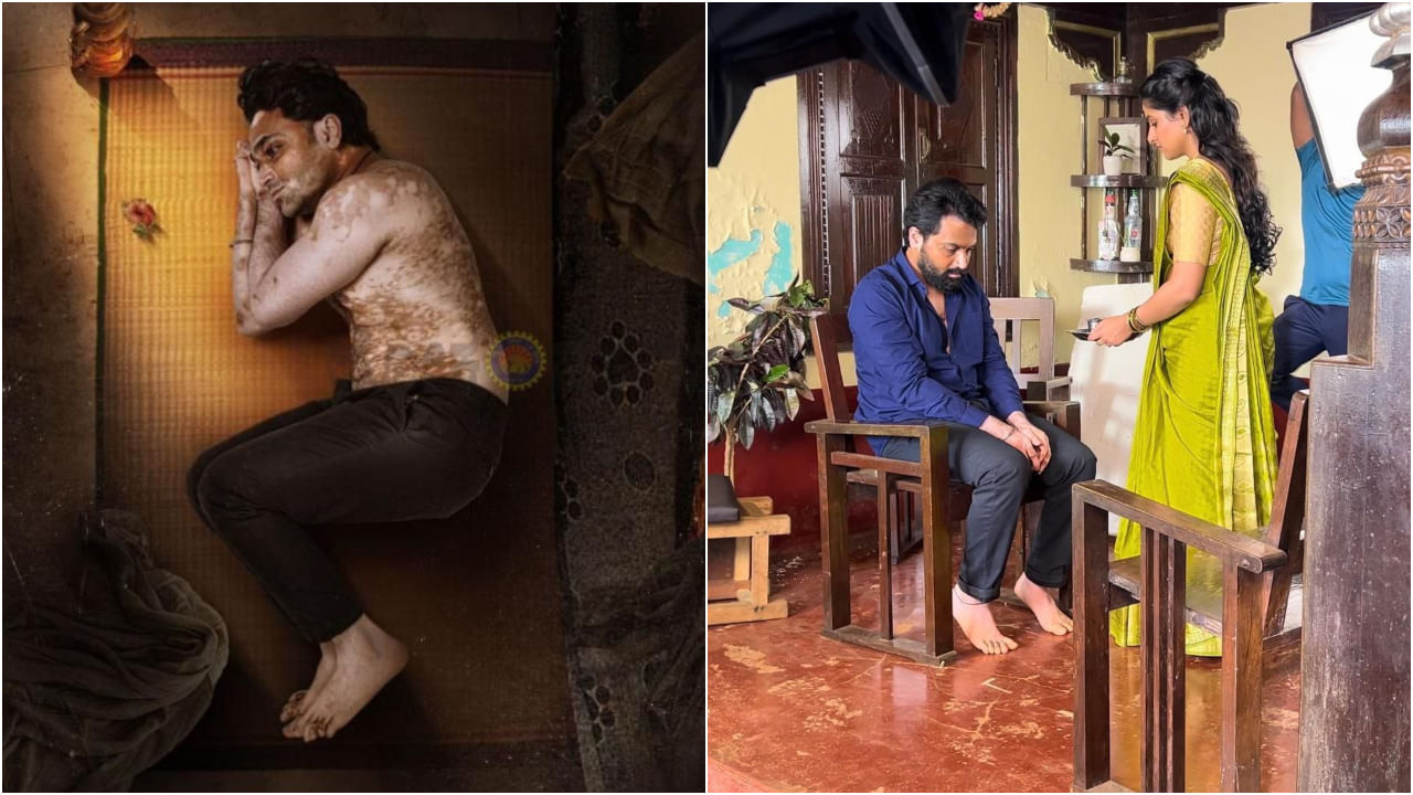 ತೊನ್ನು ಸಮಸ್ಯೆ ಕುರಿತ ‘ಬಿಳಿಚುಕ್ಕಿ ಹಳ್ಳಿಹಕ್ಕಿ’ ಸಿನಿಮಾ ಅಕ್ಟೋಬರ್ 24ಕ್ಕೆ ಬಿಡುಗಡೆ