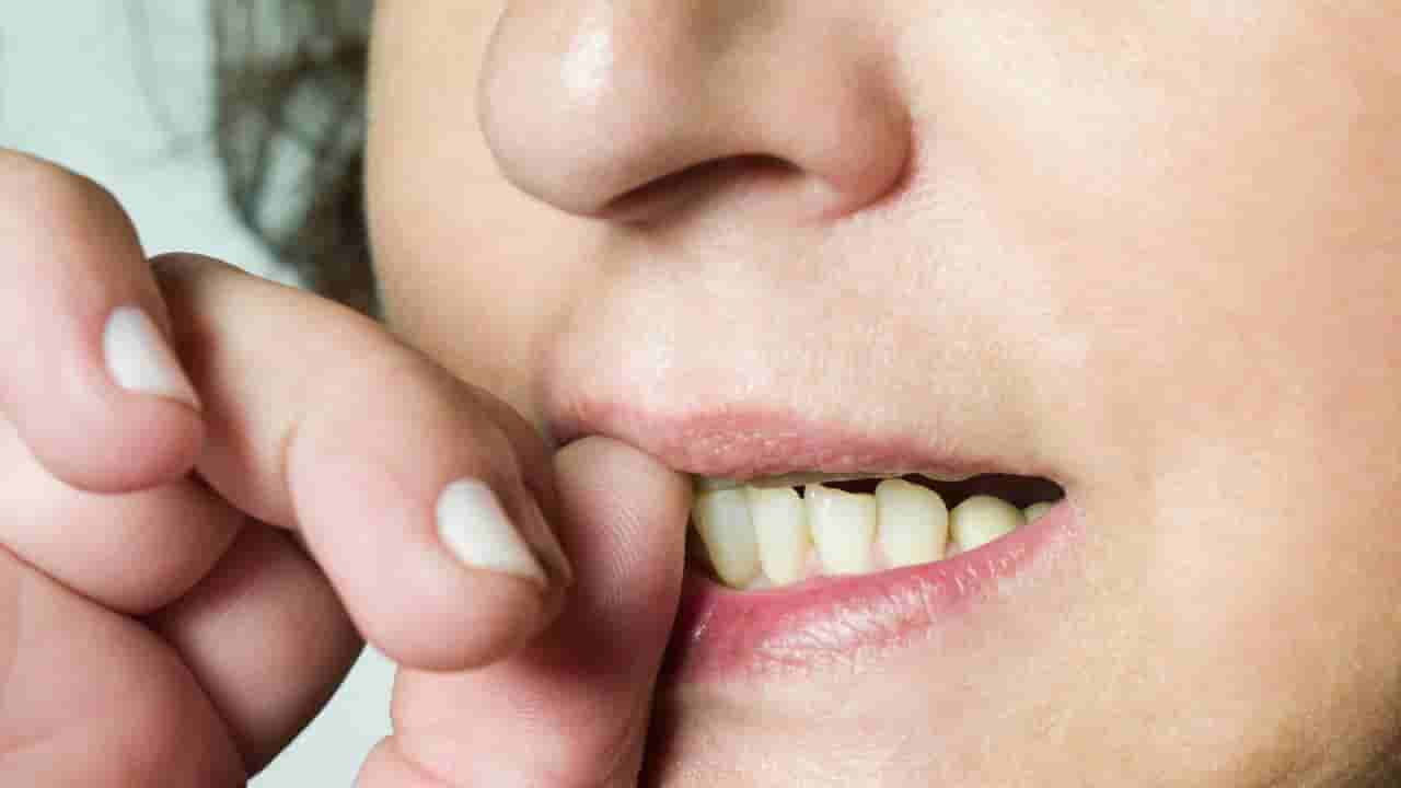 ಉಗುರು ಕಚ್ಚುವ ಅಭ್ಯಾಸ ಆರೋಗ್ಯ ಹಾಳು ಮಾಡುವುದರ ಜೊತೆಗೆ ಹಣದ ಕೊರತೆ ಉಂಟುಮಾಡುತ್ತೆ! ಹೇಗೆ ಗೊತ್ತಾ?