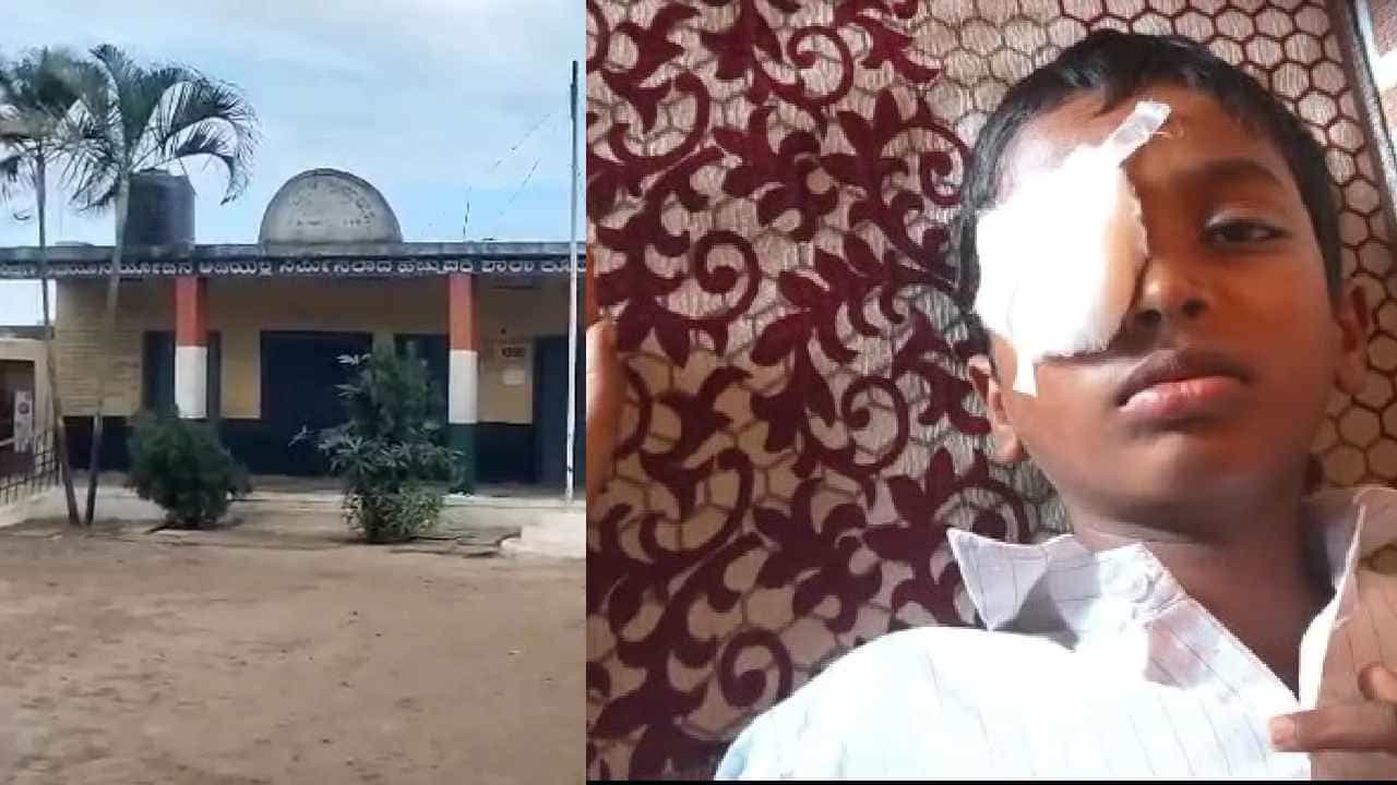 ಪೆನ್ನು ವಿಚಾರಕ್ಕೆ ಜಗಳ: 5ನೇ ಕ್ಲಾಸ್ ವಿದ್ಯಾರ್ಥಿಯ ಕಣ್ಣುಗುಡ್ಡೆಯನ್ನೇ ಕಿತ್ತ 1ನೇ ತರಗತಿ ವಿದ್ಯಾರ್ಥಿ! ಪೆನ್ನು ವಿಚಾರಕ್ಕೆ ಜಗಳ: 5ನೇ ಕ್ಲಾಸ್ ವಿದ್ಯಾರ್ಥಿಯ ಕಣ್ಣುಗುಡ್ಡೆಯನ್ನೇ ಕಿತ್ತ 1ನೇ ತರಗತಿ ವಿದ್ಯಾರ್ಥಿ!