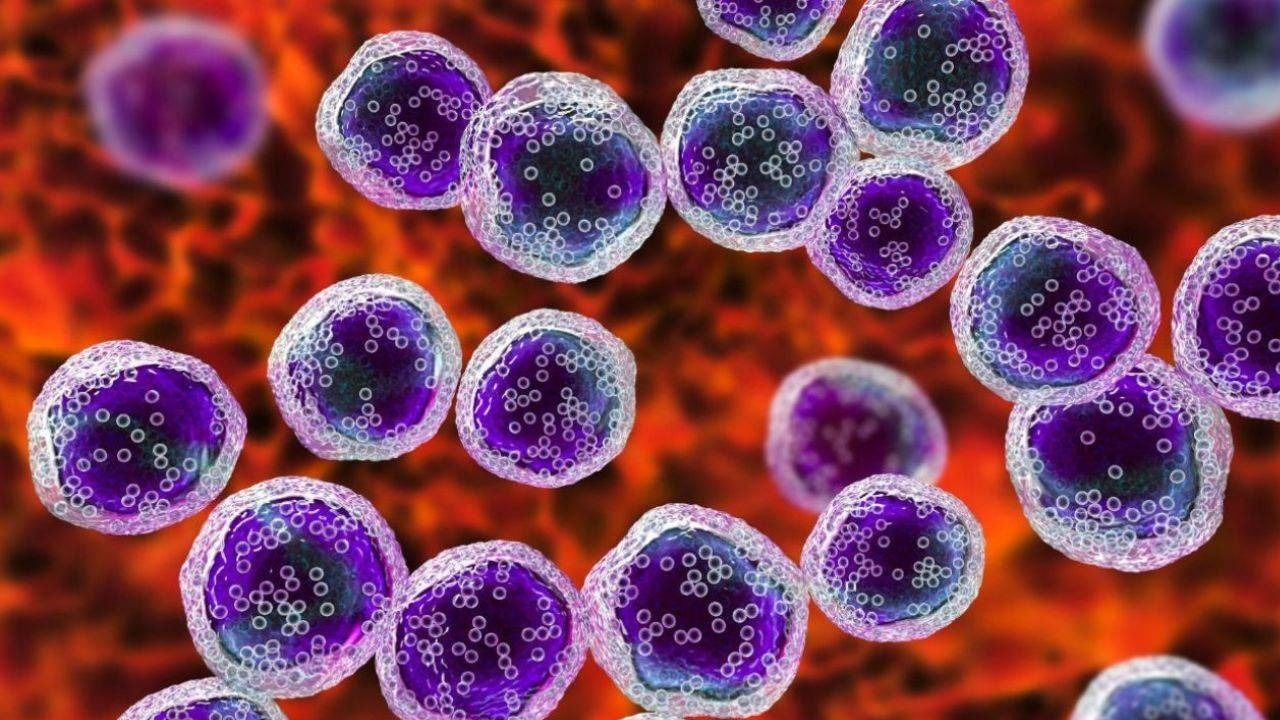 ಈ ಲಕ್ಷಣ ಕಡೆಗಣಿಸದಿದ್ದರೆ ಲಿಂಫೋಮಾ ಕ್ಯಾನ್ಸರ್ ಗುಣಪಡಿಸಬಹುದು ಎನ್ನುತ್ತಾರೆ ಡಾ. ಪ್ರಶಾಂತ ಬಿ