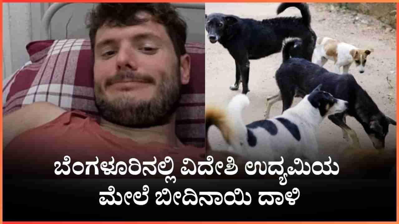 Viral: ಬೆಂಗಳೂರಿನಲ್ಲಿ ವಿದೇಶಿ ಉದ್ಯಮಿ ಮೇಲೆ ನಾಯಿ ದಾಳಿ, ಬೆಡ್ ಮೇಲೆ ಮಲಗಿ ಶ್ವಾನಗಳನ್ನು ಪ್ರೀತಿಸುವೆ ಎಂದು ವ್ಯಂಗ್ಯ ಪೋಸ್ಟ್