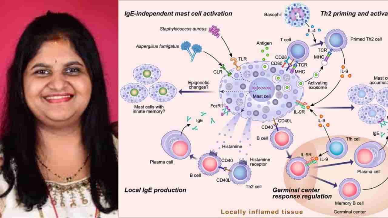 ವಿರಳಾತಿವಿರಳ ಕಾಯಿಲೆಯಿಂದ ಬಳಲುತ್ತಿದ್ದ ಚಾಂದಿನಿ ಕೊನೆಗೂ ಸಾವು; ಏನಿದು ಅಪರೂಪದ ಕಾಯಿಲೆ?