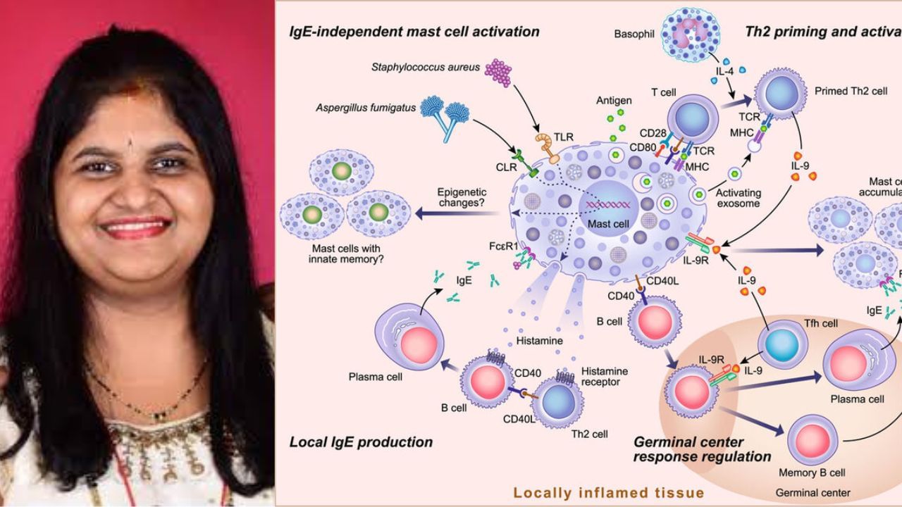 ವಿರಳಾತಿವಿರಳ ಕಾಯಿಲೆಯಿಂದ ಬಳಲುತ್ತಿದ್ದ ಚಾಂದಿನಿ ಕೊನೆಗೂ ಸಾವು; ಏನಿದು ಅಪರೂಪದ ಕಾಯಿಲೆ?