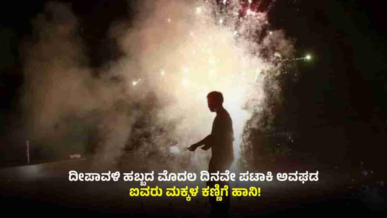 ಬೆಂಗಳೂರು: ದೀಪಾವಳಿ ಹಬ್ಬದ ಮೊದಲ ದಿನವೇ ಪಟಾಕಿ ಅವಘಡ; ಐವರು ಮಕ್ಕಳು ಸೇರಿ ಹಲವರಿಗೆ ಗಾಯ