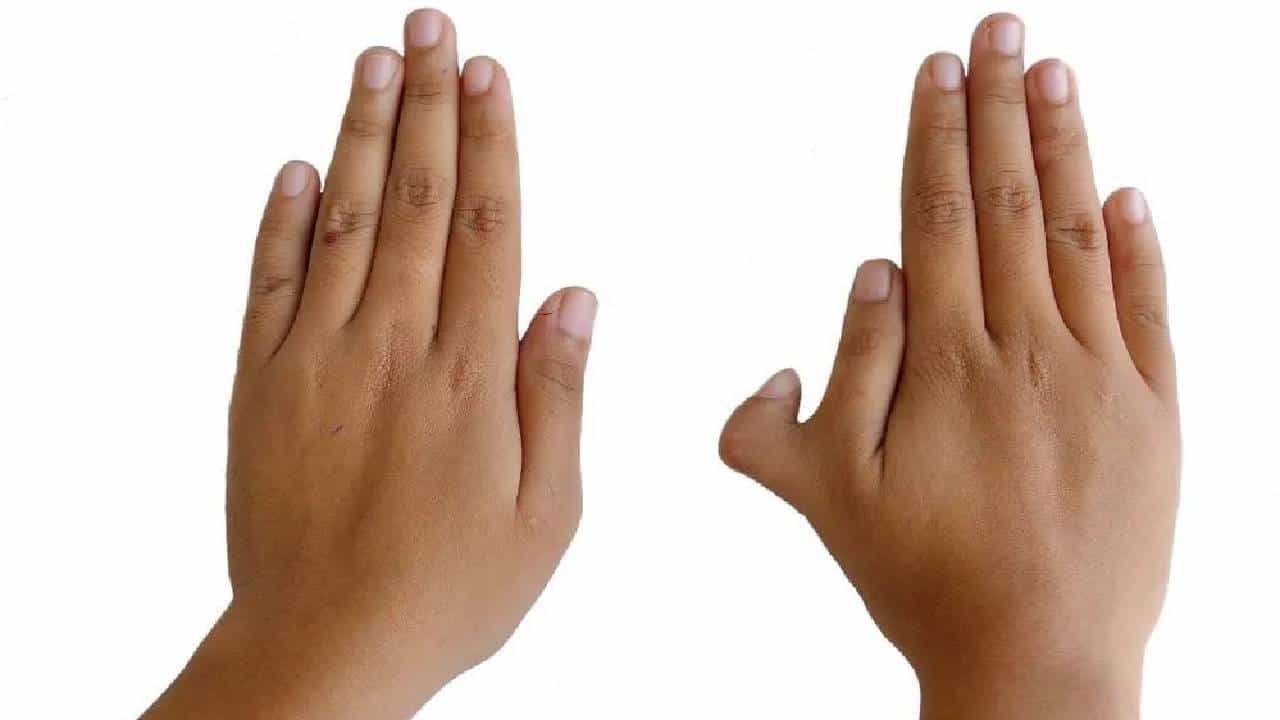 Daily Devotional: ಬಲಗೈಯಲ್ಲಿ 6 ಬೆರಳಿದ್ರೆ ಏನರ್ಥ? ಜ್ಯೋತಿಷ್ಯ ಶಾಸ್ತ್ರ ಹೇಳುವುದೇನು? Daily Devotional: ಬಲಗೈಯಲ್ಲಿ 6 ಬೆರಳಿದ್ರೆ ಏನರ್ಥ? ಜ್ಯೋತಿಷ್ಯ ಶಾಸ್ತ್ರ ಹೇಳುವುದೇನು?