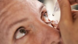 ಋತುಬಂಧವು ವೆರಿಕೋಸ್ ವೇನ್ಸ್‌ಗೆ ಕಾರಣವಾಗಬಹುದೇ? ವೈದ್ಯರು ನೀಡಿರುವ ಮಾಹಿತಿ ಇಲ್ಲಿದೆ