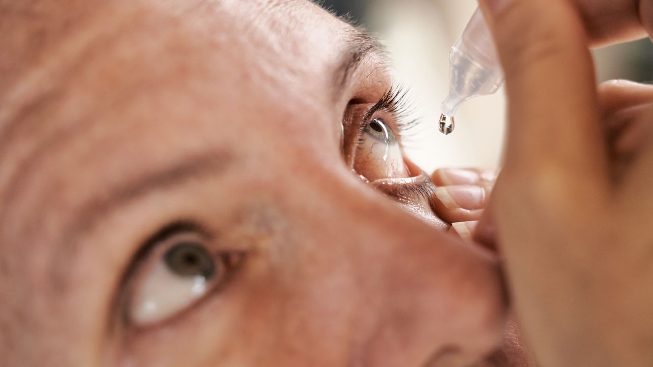 ಐ ಡ್ರಾಪ್ ಹಾಕಿಕೊಳ್ಳುವಾಗ ಅಪ್ಪಿತಪ್ಪಿಯೂ ಈ ತಪ್ಪುಗಳನ್ನು ಮಾಡಬೇಡಿ