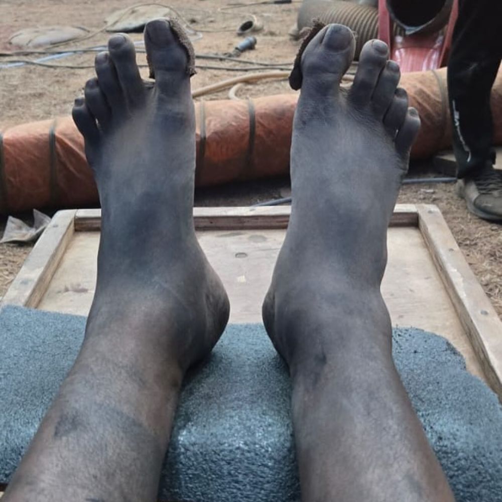 ‘ಕಾಂತಾರ: ಚಾಪ್ಟರ್ 1’ ಸಿನಿಮಾದ ಕ್ಲೈಮ್ಯಾಕ್ಸ್ ಚಿತ್ರೀಕರಣದ ಸಮಯದಲ್ಲಿ ಕಾಲುಗಳು ಊದಿಕೊಂಡು ಇಡೀ ದೇಹವೇ ನಿತ್ರಾಣವಾಗಿತ್ತಂತೆ ರಿಷಬ್ ಶೆಟ್ಟಿಗೆ. ಆದರೂ ಬಿಡದೇ ಚಿತ್ರೀಕರಣ ಮಾಡಿದ್ದಾರೆ.