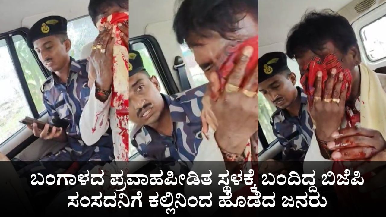 ಬಂಗಾಳದ ಪ್ರವಾಹಪೀಡಿತ ಸ್ಥಳಕ್ಕೆ ಬಂದಿದ್ದ ಬಿಜೆಪಿ ಸಂಸದನಿಗೆ ಕಲ್ಲಿನ ದಾಳಿ; ಮುಖವೆಲ್ಲ ರಕ್ತಸಿಕ್ತ!