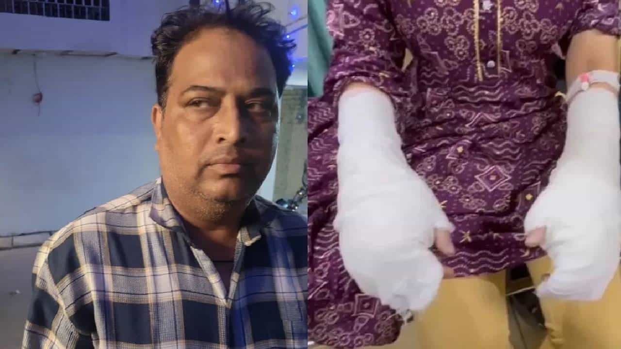 ದೆಹಲಿಯ ವಿದ್ಯಾರ್ಥಿನಿ ಮೇಲೆ ಆ್ಯಸಿಡ್ ದಾಳಿ ನಡೆದಿದ್ದು ಸುಳ್ಳಾ, ತಂದೆಯೇ ಮಗಳ ಕೈಗೆ ಸುರಿದಿದ್ರಾ ಟಾಯ್ಲೆಟ್ ಕ್ಲೀನರ್? ದೆಹಲಿಯ ವಿದ್ಯಾರ್ಥಿನಿ ಮೇಲೆ ಆ್ಯಸಿಡ್ ದಾಳಿ ನಡೆದಿದ್ದು ಸುಳ್ಳಾ, ತಂದೆಯೇ ಮಗಳ ಕೈಗೆ ಸುರಿದಿದ್ರಾ ಟಾಯ್ಲೆಟ್ ಕ್ಲೀನರ್?