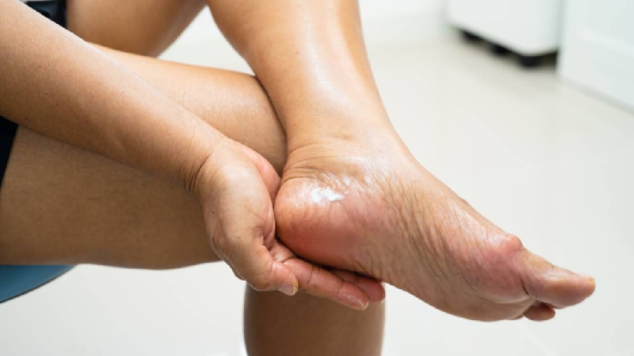 Winter Tips: ಬಿರುಕು ಬಿಟ್ಟ ಹಿಮ್ಮಡಿಯನ್ನು ಗುಣಪಡಿಸಲು ಸಹಕಾರಿ ಈ ಮನೆಮದ್ದುಗಳು