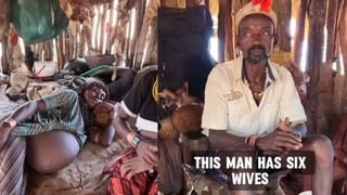 ಈ ರೈತ 62 ವರ್ಷದಲ್ಲಿ ಒಮ್ಮೆಯೂ ನಿದ್ದೆ ಮಾಡಿಲ್ಲ, ಇದು ವಿಜ್ಞಾನ ಲೋಕಕ್ಕೆ ಅಚ್ಚರಿ