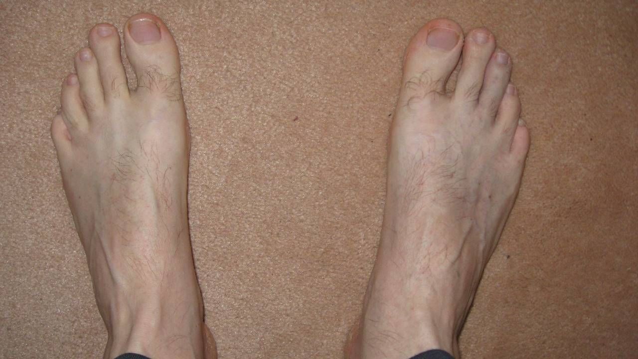 Personality Test: ಕಾಲ್ಬೆರಳುಗಳ ಮೇಲೆ ಕೂದಲಿರುವ ಜನರ ಸ್ವಭಾವ ಹೇಗಿರುತ್ತೆ ಗೊತ್ತಾ?