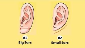 ನಿಮ್ಮ ಕಿವಿಯ ಆಕಾರ ಹೇಗಿದೆ?