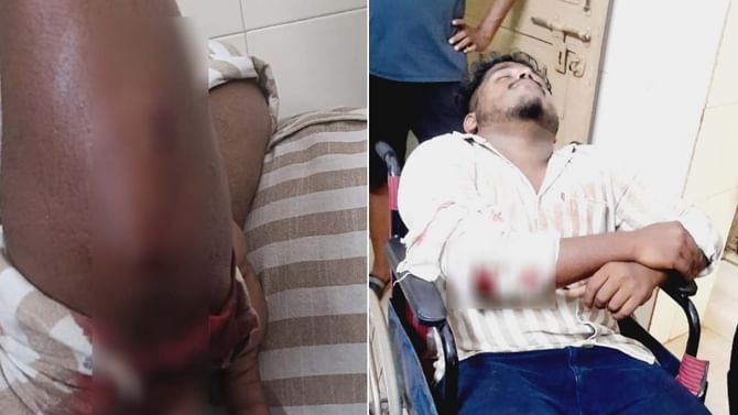 ಮಂಗಳೂರಿನಲ್ಲಿ ಯುವಕನ‌ ಮೇಲೆ ತಲ್ವಾರ್‌ನಿಂದ ದಾಳಿ: ವಿಡಿಯೋ ನೋಡಿ