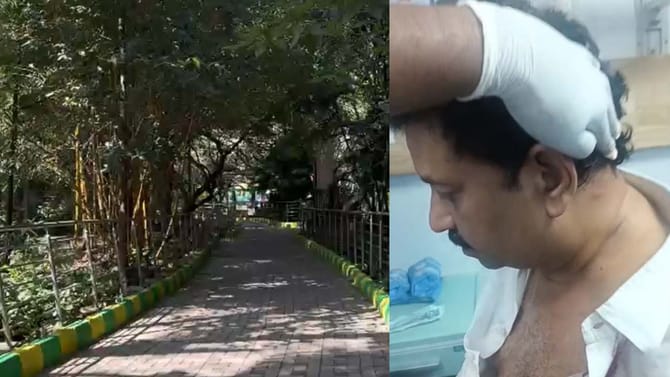 ಬೆಂಗಳೂರಿನಲ್ಲಿ ಉದ್ಯಮಿ ಮೇಲೆ ಫೈರಿಂಗ್​: ಕೂದಲೆಳೆ ಅಂತರದಲ್ಲಿ ಬಚಾವ್​!