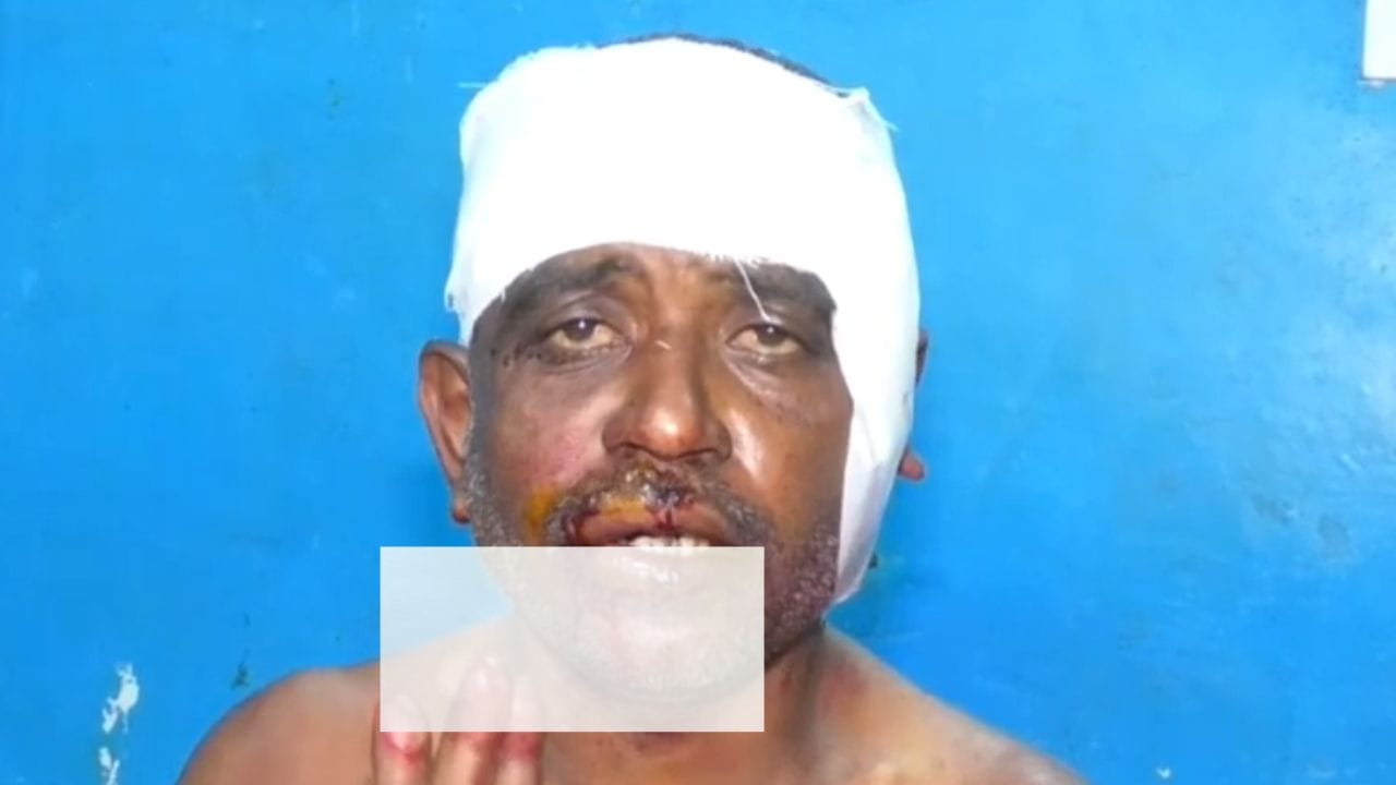 ಕುಡಿದ ಅಮಲಿನಲ್ಲಿ ಕಿರಿಕ್: ವ್ಯಕ್ತಿ ತಲೆಗೆ ಬಿಯರ್ ಬಾಟಲಿಂದ ಹೊಡೆದ ಗ್ಯಾಂಗ್ ಕುಡಿದ ಅಮಲಿನಲ್ಲಿ ಕಿರಿಕ್: ವ್ಯಕ್ತಿ ತಲೆಗೆ ಬಿಯರ್ ಬಾಟಲಿಂದ ಹೊಡೆದ ಗ್ಯಾಂಗ್