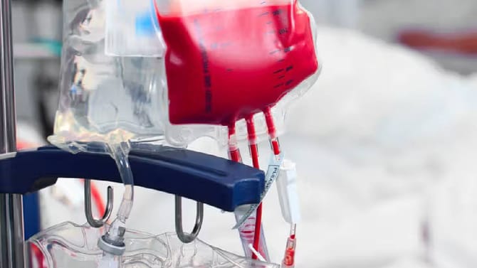 ರಕ್ತ ನಿಧಿಯಿಂದ ರಕ್ತ ಪಡೆದಿದ್ದ ನಾಲ್ವರು ಮಕ್ಕಳಿಗೆ ಎಚ್​ಐವಿ ಸೋಂಕು