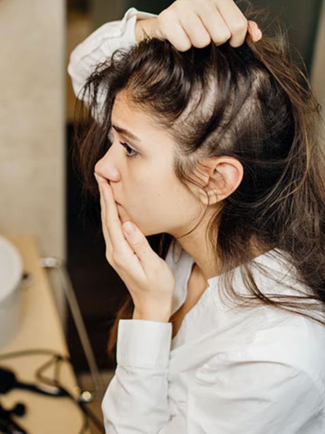 ಕೂದಲು ಉದುರುವ ಸಮಸ್ಯೆಗೆ ಈ ಆಹಾರಗಳೂ ಕಾರಣ