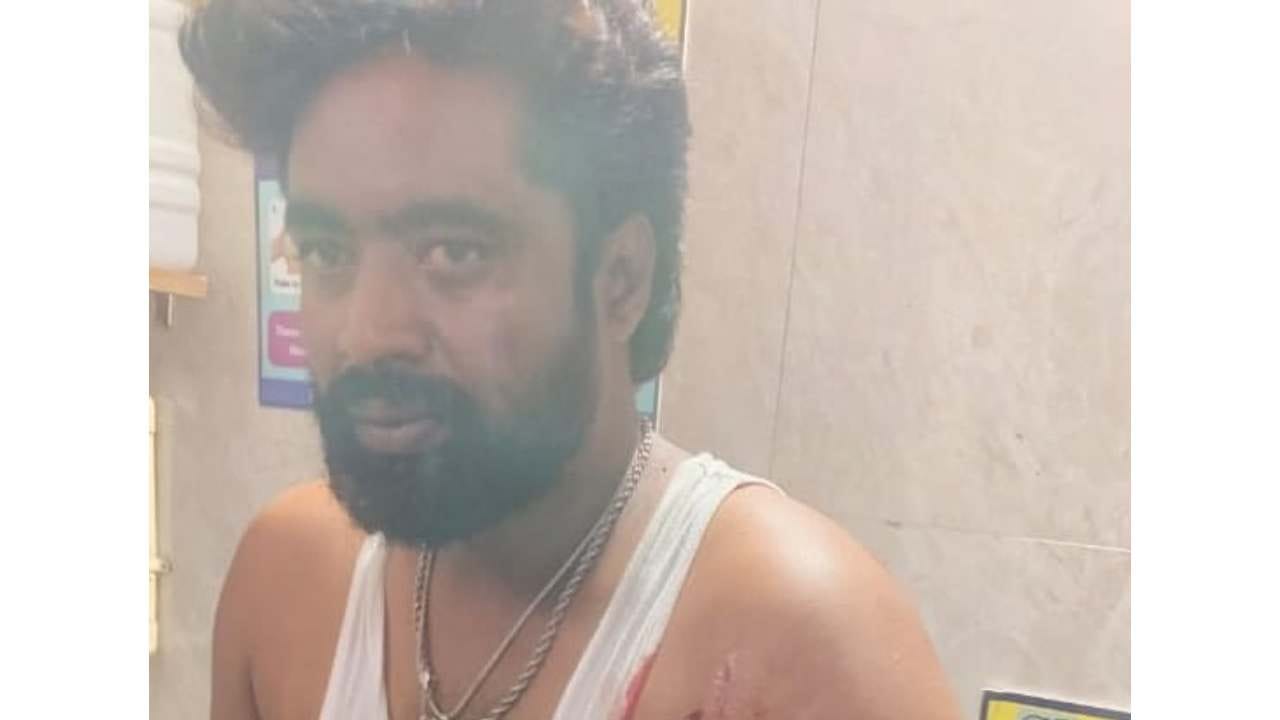 ಚಾಮರಾಜನಗರ: ಕಾಂಗ್ರೆಸ್ ಯುವ ಮುಖಂಡನಿಗೆ ಚಾಕು ಇರಿತ, ಆಗಿದ್ದೇನು?