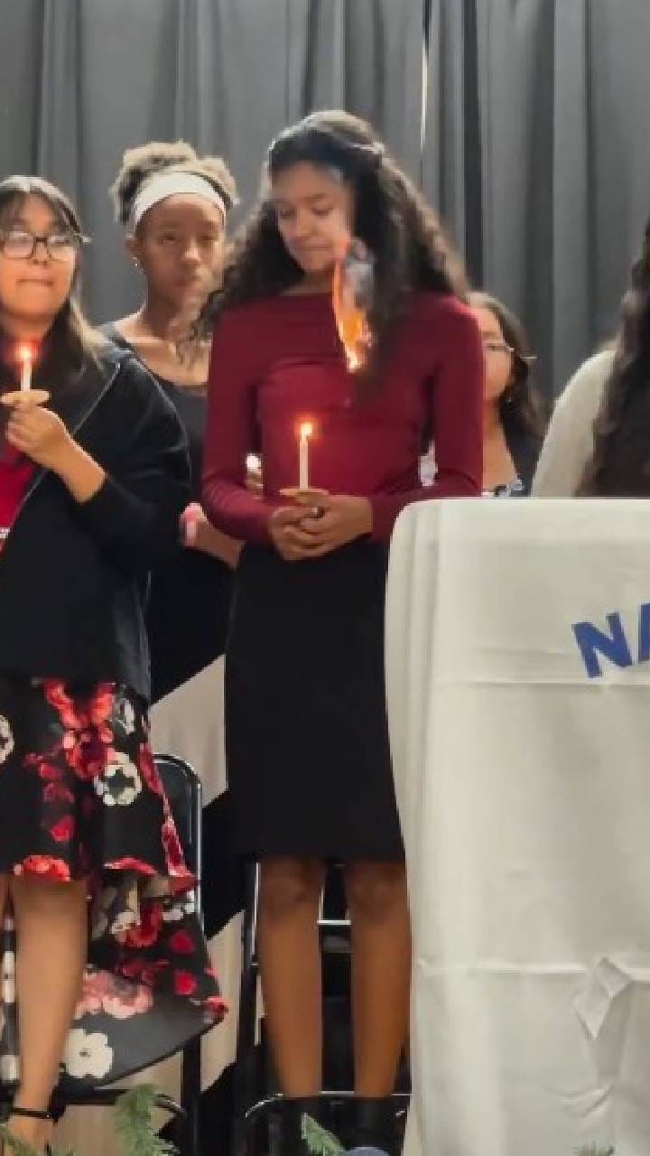 ಕೂದಲಿಗೆ ಬೆಂಕಿ ಹತ್ತಿದ್ರೂ ಚೂರೂ ಭಯಪಡದೆ ಆರಿಸಿದ ಯುವತಿ