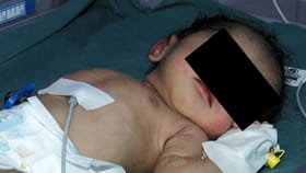 ಮುಳ್ಳಿನ ಪೊದೆಯಲ್ಲಿ ಒದ್ದಾಡಿದ ಒಂದು ದಿನದ ಹೆಣ್ಣು ಮಗು